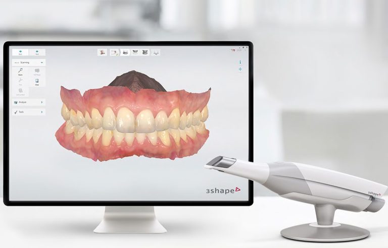 Diagnóstico digital Escáner intraoral utilizado para diagnóstico digital